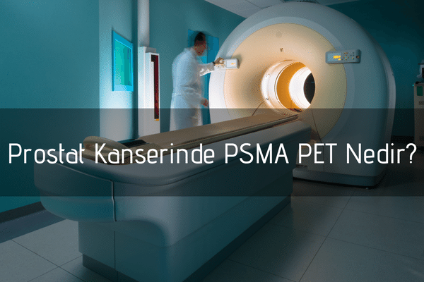 Prostat Kanserinde PSMA PET Nedir?