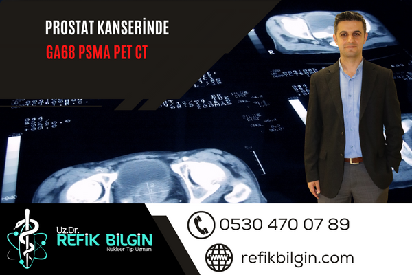 Prostat Kanserinde Ga68 PSMA PET CT